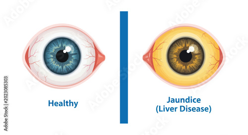 Quadro su tela Healthy Eye vs
