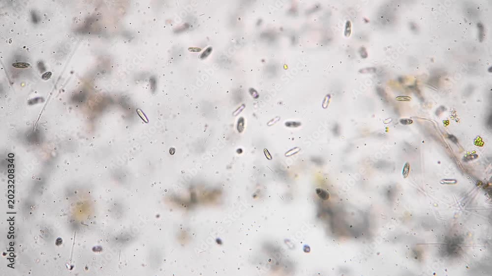 Organic sediment particles mixed with microbes under microscope, fine ...