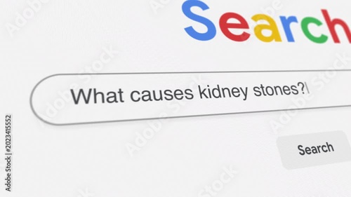 What causes kidney stones Search Prompt