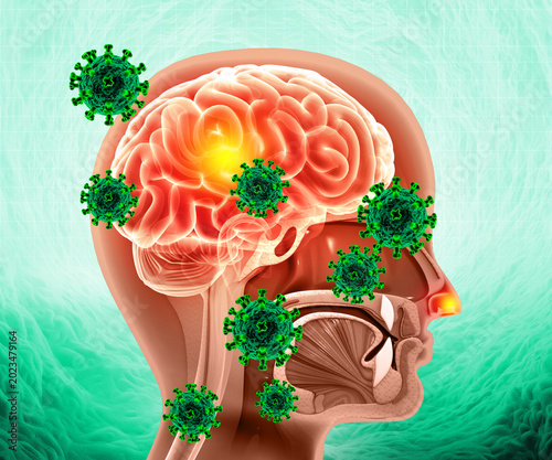 Bild auf Leinwand Brain viral infection, Viral meningitis and encephalitis