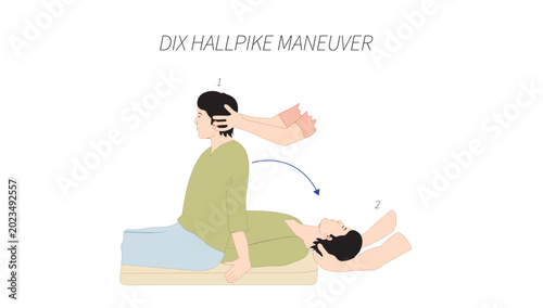 Tableau sur toile Dix-Hallpike Maneuver
Step-by-step clinical illustration of the Dix-Hallpike maneuver used to diagnose benign paroxysmal positional vertigo (BPPV)
