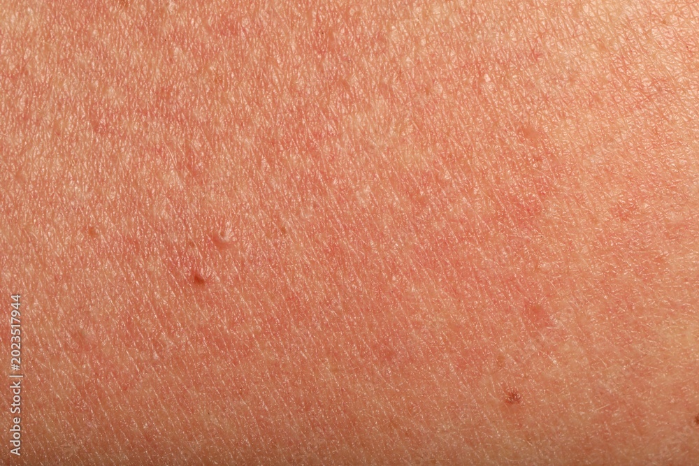 Fototapeta premium Texture of normal skin as background, closeup