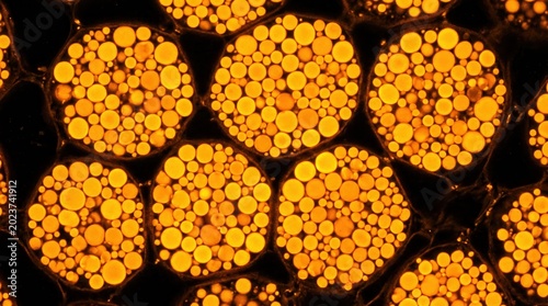 Adipocyte Lipid Droplet Accumulation CARS Microscopy