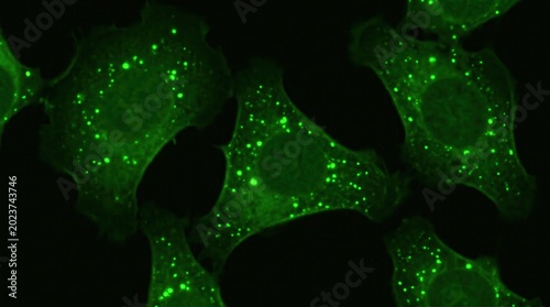 Autophagosome Formation LC3 Puncta Live Cell Imaging