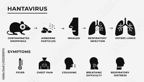 Foto Hantavirus transmission and symptoms infographic with icons and medical terminol