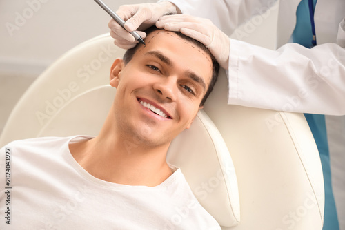 Fotografie Doctor marking young man's head with hair loss problem on couch in clinic, close
