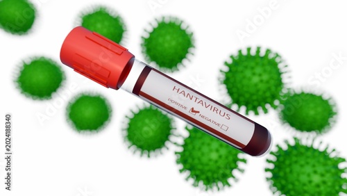 Foto A 3D medical illustration of blood collection tubes with caps labeled HANTAVIRUS and spiked hantavirus macromolecule