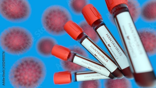 Bild auf Leinwand A 3D medical illustration of blood collection tubes with caps labeled HANTAVIRUS and spiked hantavirus macromolecule