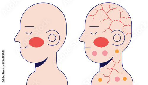 Slika na platnu Conceptual illustration of male head showcasing a healthy side and a stressed or inflamed side with cracked skin