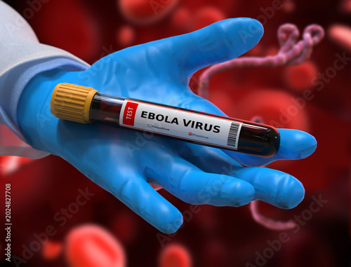 Quadro em tela Ebola blood test tube with positive result