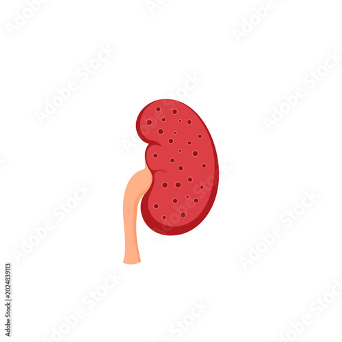 kidney infection Illustration 