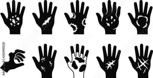 Photos Hantavirus Silhouettes of hands showing various skin conditions and injuries inj