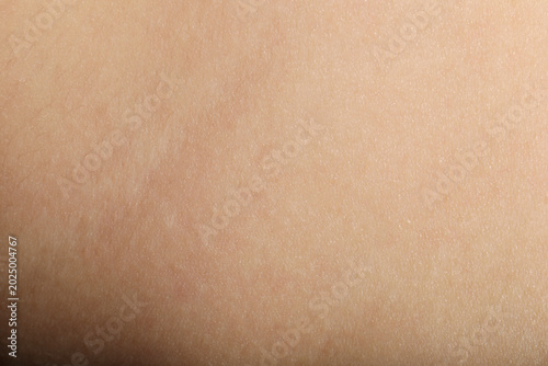 Tableau sur toile Texture of normal skin as background, closeup