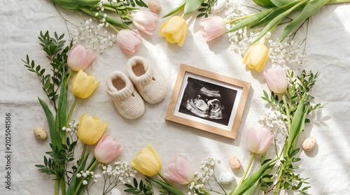 Beautiful spring pregnancy announcement with tulips baby shoes and ultrasound photograph.