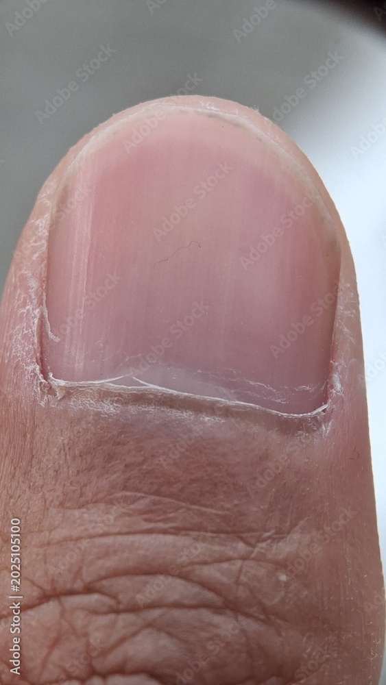 Fototapeta premium close up of human skin