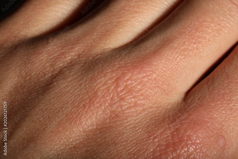 Naklejka premium Human hand with normal skin as background, closeup