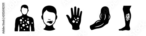 Φωτογραφία Set of medical and healthcare icons representing skin rash, allergic reaction, swollen lip, muscle growth, and varicose veins