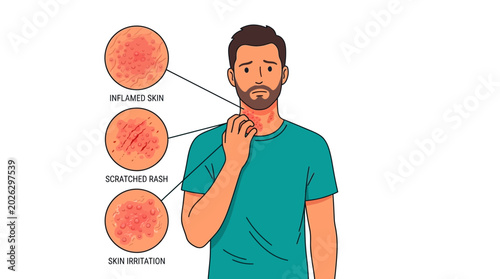 Man scratching itchy red skin rash on neck with medical callouts
