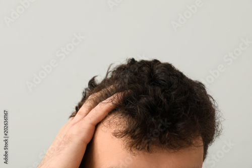 Tableau sur toile Young man touching curly hair and receding hairline close up, concept of hair lo