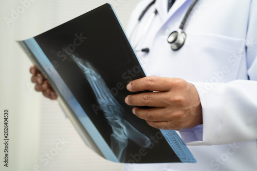 фотографія Doctor examining foot ankle  joint bone radiography xray film.