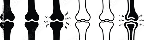 Foto Joint pain arthritis icon set, knee pain musculoskeletal disorder physiotherapy and healthcare symbols for medical treatment and wellness design