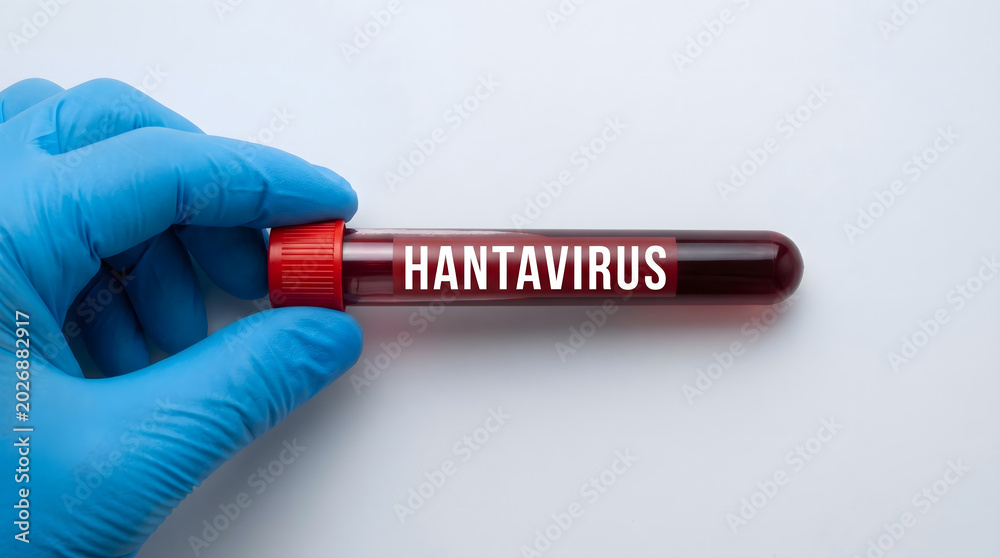 Obraz premium Gloved hand holding horizontal hantavirus labeled blood tube with red label on white background