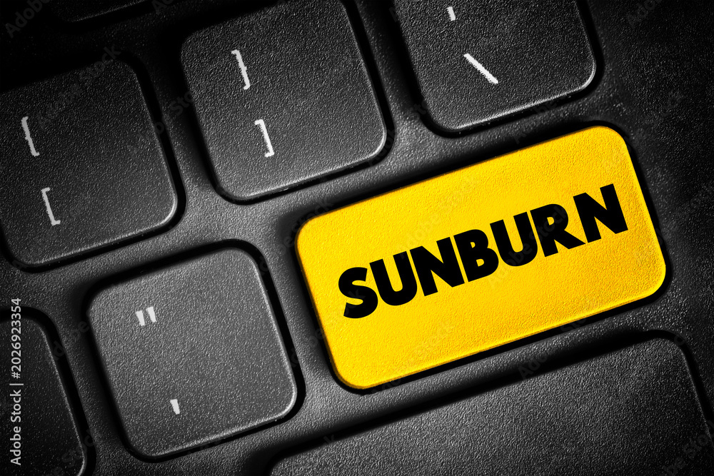 Fototapeta premium Sunburn is a form of radiation burn that affects living tissue, such as skin, text button on keyboard, concept background