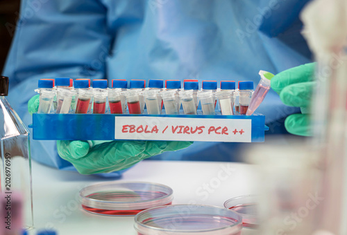 A scientist examines an Ebola virus PCR test in a laboratory
