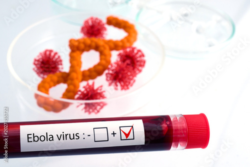 Ebola virus positive blood test result in laboratory setting
