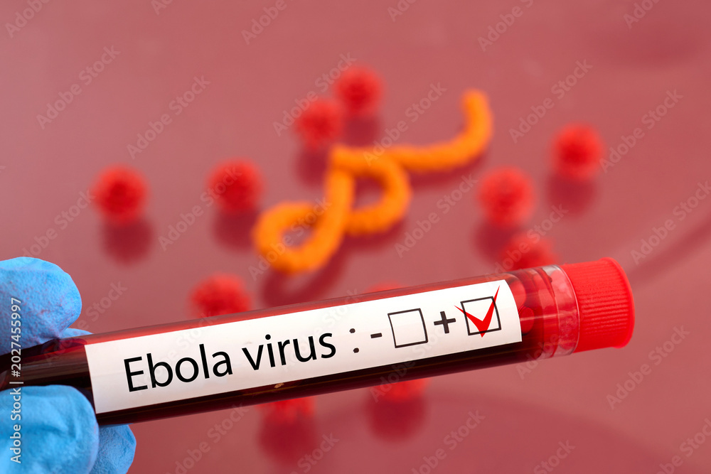 Obraz premium Hand holding ebola virus positive blood test