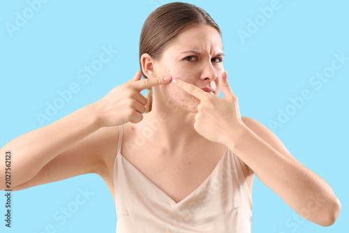 Teenage girl with acne prob...
