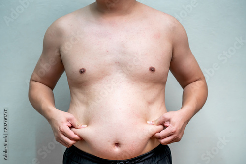 Schilderij op canvas Overweight man pinches abdominal fat with both hands while standing against plain background