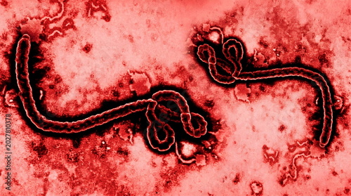 Color electron micrograph of the Ebola virus, a highly dangerous filamentous filovirus that causes hemorrhagic fever.