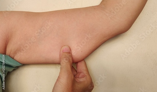 Fotografía woman holding the flabbiness adipose sagging skin, wrinkle and Flabby skin under the arm, armpit and loose on the body of the woman, health care and beauty concept