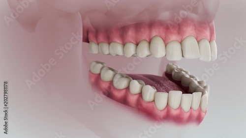 An animation of orthodontic treatment demonstrating the correction of misaligned teeth and bite improvement. A professional visualization of dental procedures for achieving a perfect, straight smile.