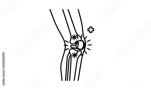 Quadro su tela Orthopedic knee pain icon with damaged ligaments and aging joint structure medic