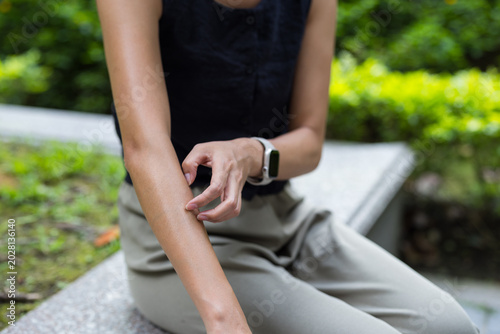 Young woman scratching her itchy arm while sitting outside