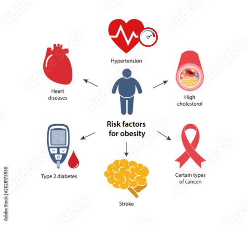 Risk factors for obesity. Flat style vector illustration isolated on a white background