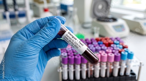 Hand in blue glove holding dengue test blood sample tube in laboratory with test tubes rack