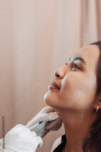 Female patient receiving fat dissolving mesotherapy injections at an aesthetic clinic for double chin reduction and jawline contouring