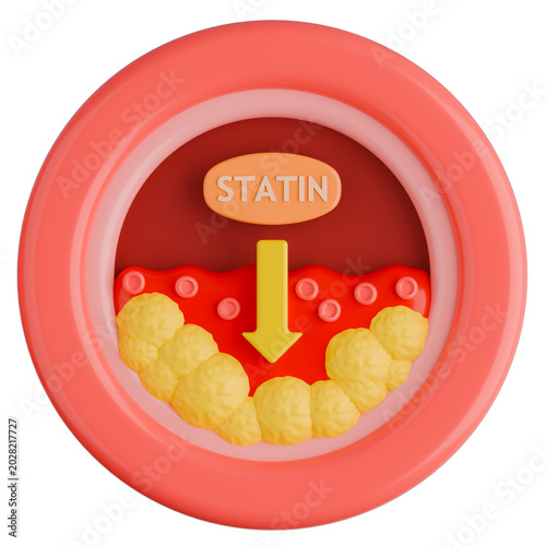 Statin Drug Lowering Cholesterol Plaque in Blood Vessel 3D Illustration.