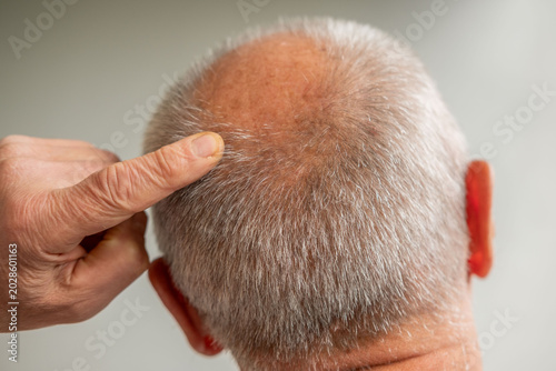 Photos Close up senior man 60-65 years old, man's head showing round bald spot on crown