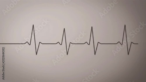 Animated EKG Heartbeat Line Drawing Transforming Into A Heart Shape Motion Graphic Video Background
