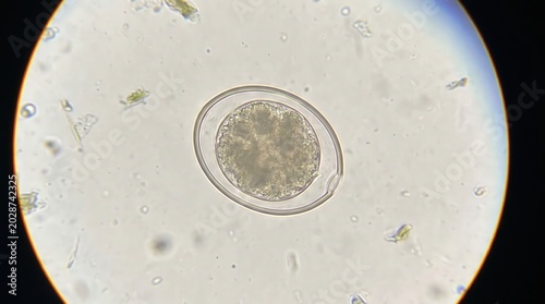 Eimeria Coccidia Oocyst Fecal Float Veterinary Stool. Eimeria species unsporulated oocyst with visible micropyle in flotation preparation from clinical veterinary diarrheal stool.