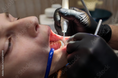 Photos extreme close up of dental scaler tip working inside wide open mouth showing low