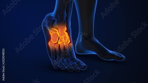 Photos Talus and navicular joint pain affecting Tarsal bones