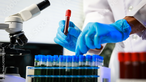 Scientist in lab coat and blue gloves holding blood sample tube near rack of test tubes and microscope, biomedical research or diagnostics concept.