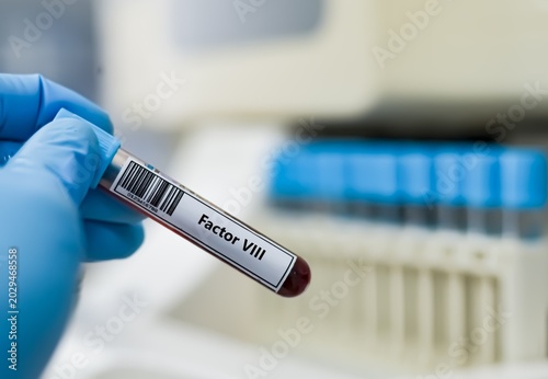 Bild auf Leinwand Blood sample tube for factor VIII test analysis.