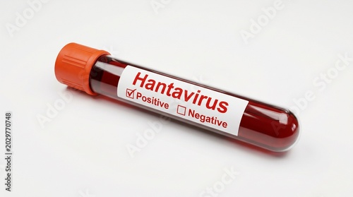 Medical blood test tube with hantavirus positive result isolated on white background