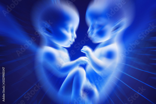 embryo twins